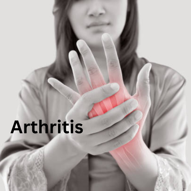 Arthritis